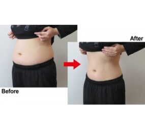 ハイパーナイフでパーツ痩せ！